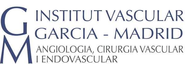 Tratamiento minimamente invasivo de las varices mediante Clarivein-MOCA