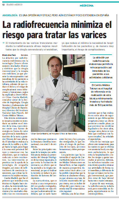 La radiofrecuencia minimiza el riesgo para tratar las varices
